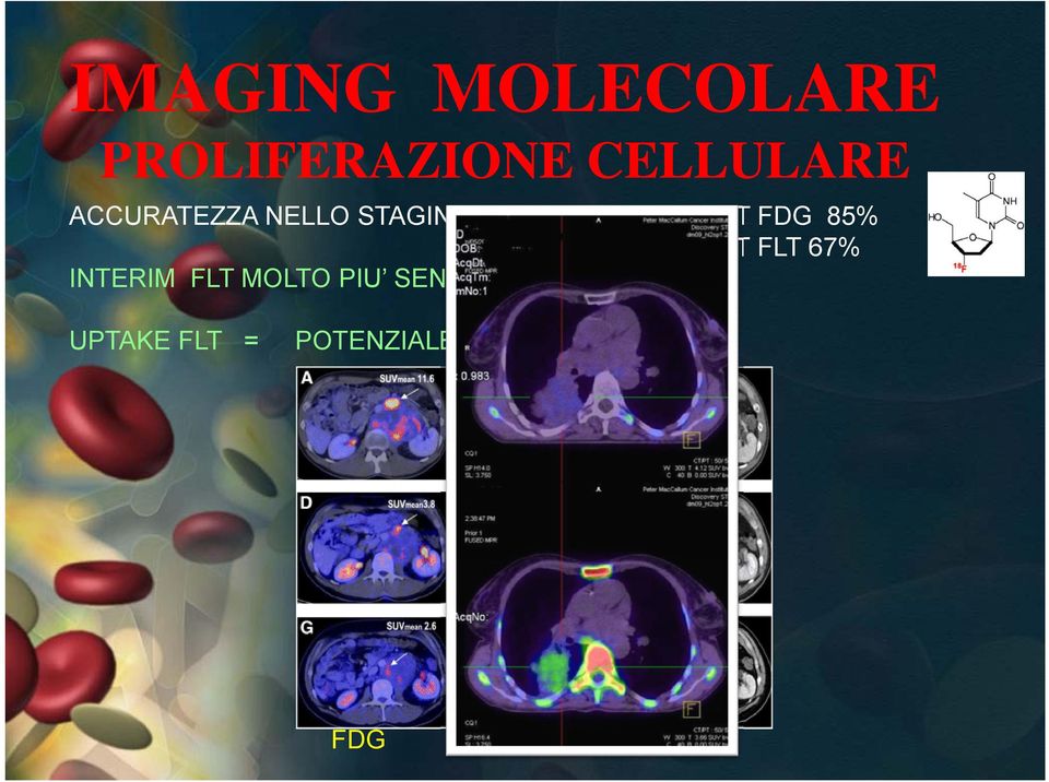 MOLTO PIU SENSIBILE DELL FDG UPTAKE FLT =