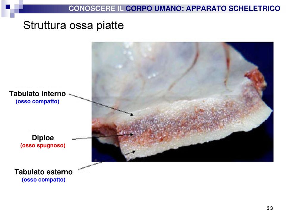 compatto) Diploe (osso