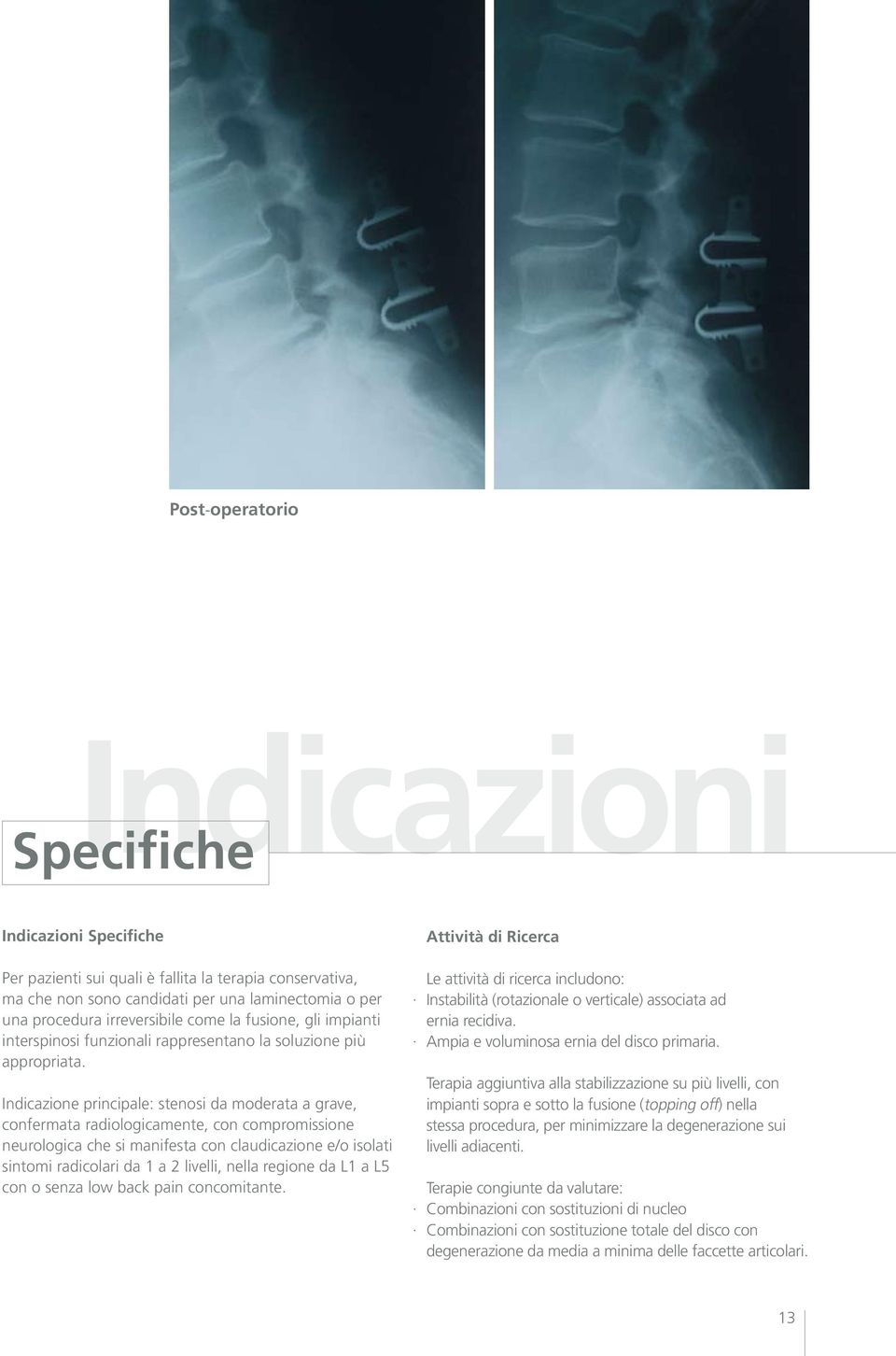 Indicazione principale: stenosi da moderata a grave, confermata radiologicamente, con compromissione neurologica che si manifesta con claudicazione e/o isolati sintomi radicolari da 1 a 2 livelli,