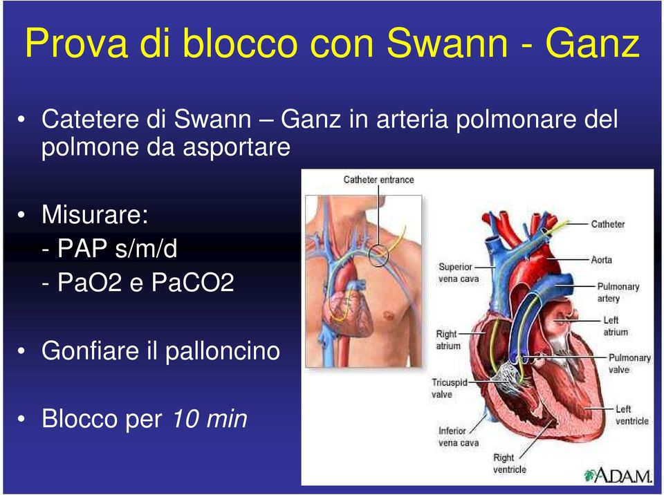 da asportare Misurare: - PAP s/m/d - PaO2 e