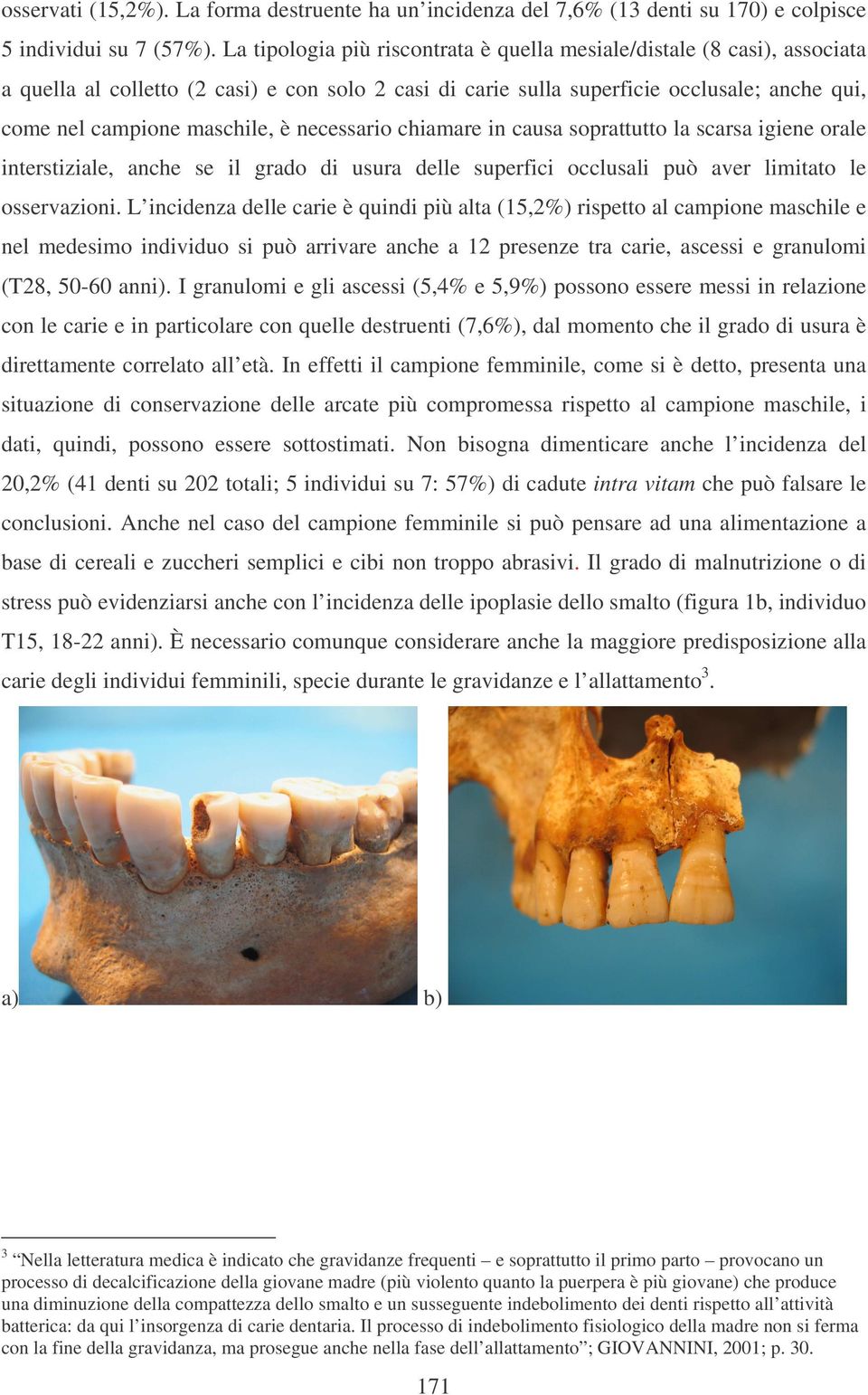 necessario chiamare in causa soprattutto la scarsa iiene orale interstiziale, anche se il rado di usura delle superfici occlusali può aver limitato le osservazioni.