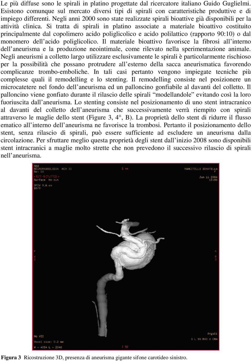 Negli anni 2000 sono state realizzate spirali bioattive già disponibili per la attività clinica.