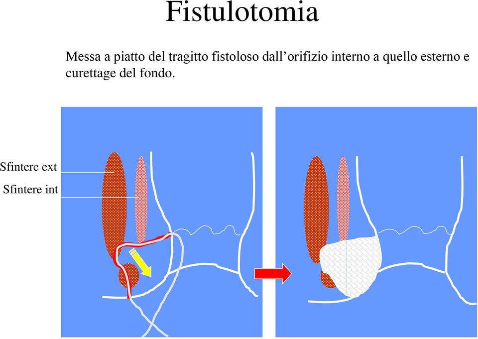 interno a quello esterno e