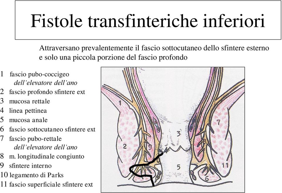 ext 3 mucosa rettale 4 linea pettinea 5 mucosa anale 6 fascio sottocutaneo sfintere ext 7 fascio