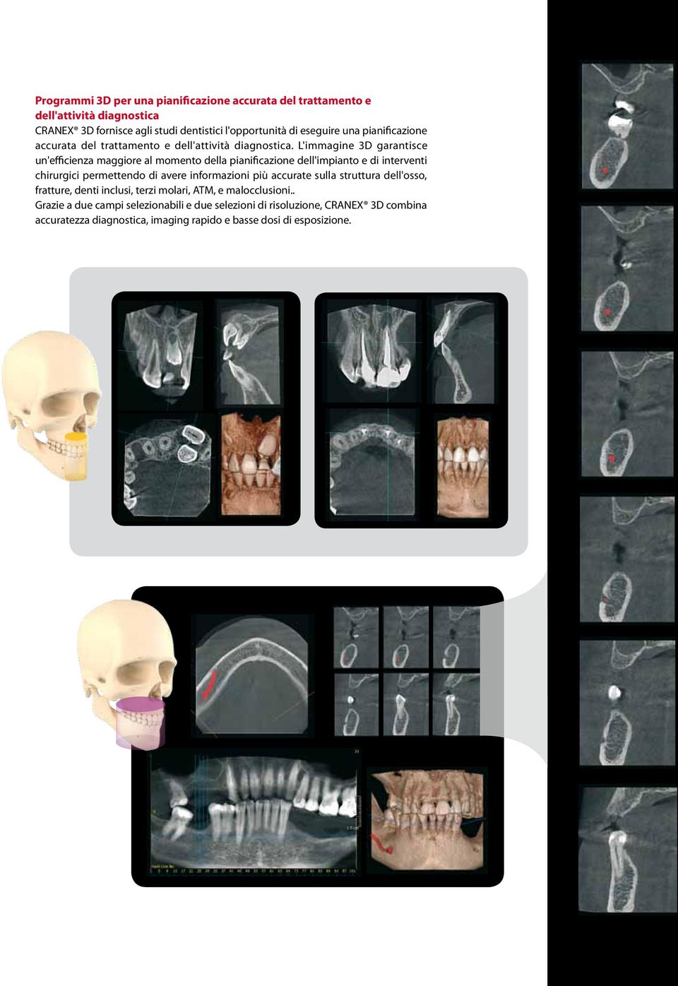 L'immagine 3D garantisce un'efficienza maggiore al momento della pianificazione dell'impianto e di interventi chirurgici permettendo di avere informazioni più