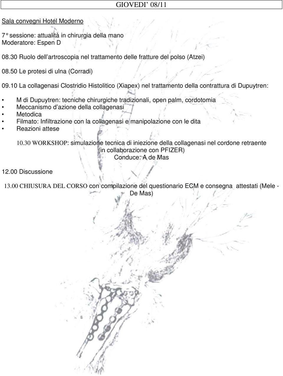 10 La collagenasi Clostridio Histolitico (Xiapex) nel trattamento della contrattura di Dupuytren: M di Dupuytren: tecniche chirurgiche tradizionali, open palm, cordotomia Meccanismo d azione