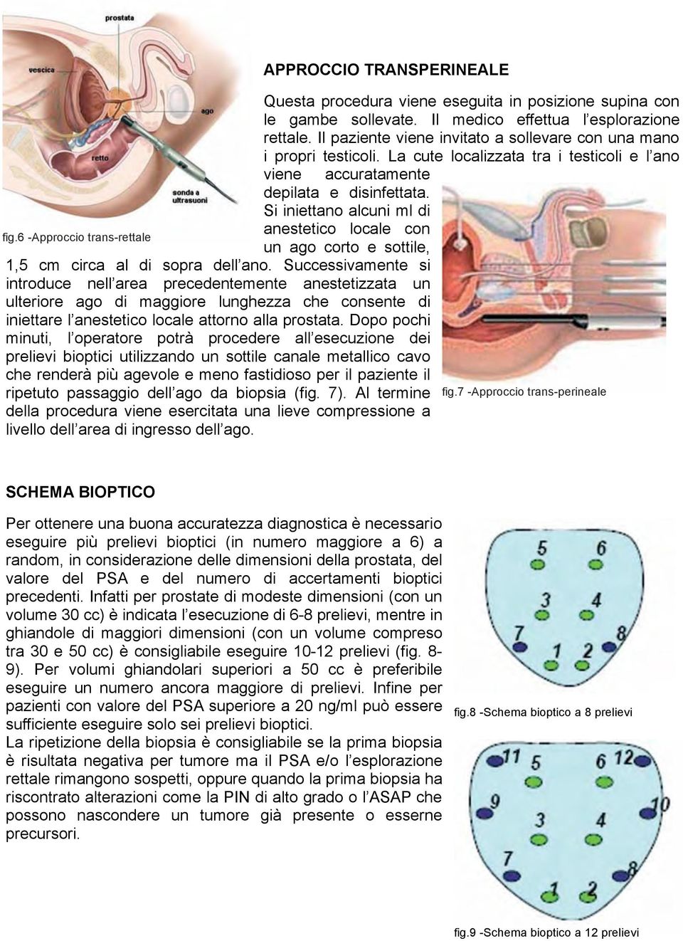 Si iniettano alcuni ml di anestetico locale con fig.6 -Approccio trans-rettale un ago corto e sottile, 1,5 cm circa al di sopra dell ano.