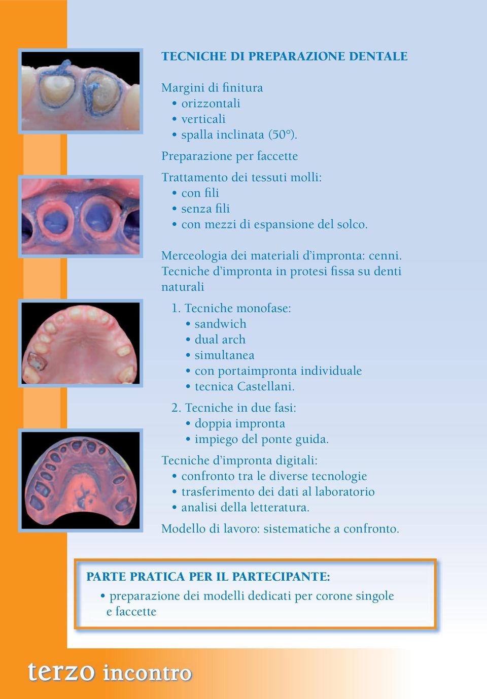 Tecniche d impronta in protesi fissa su denti naturali 1. Tecniche monofase: sandwich dual arch simultanea con portaimpronta individuale tecnica Castellani. 2.