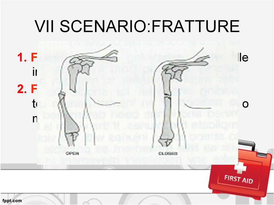 non ferite aperte 2.