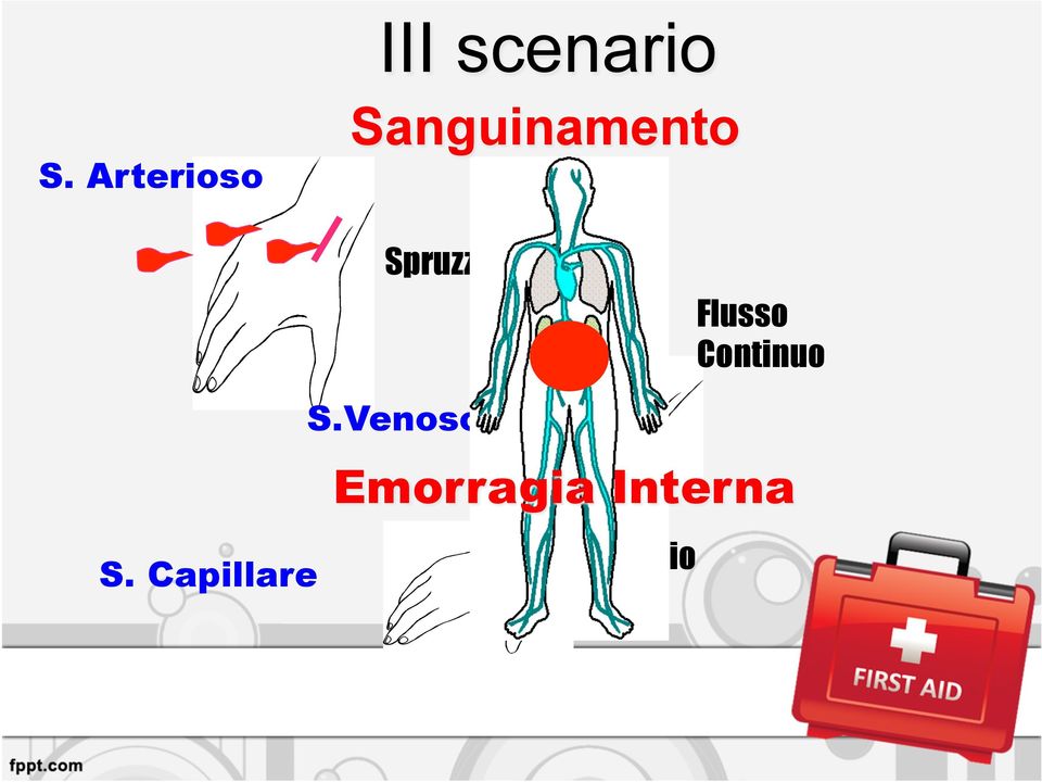 Spruzzo Flusso Continuo S.