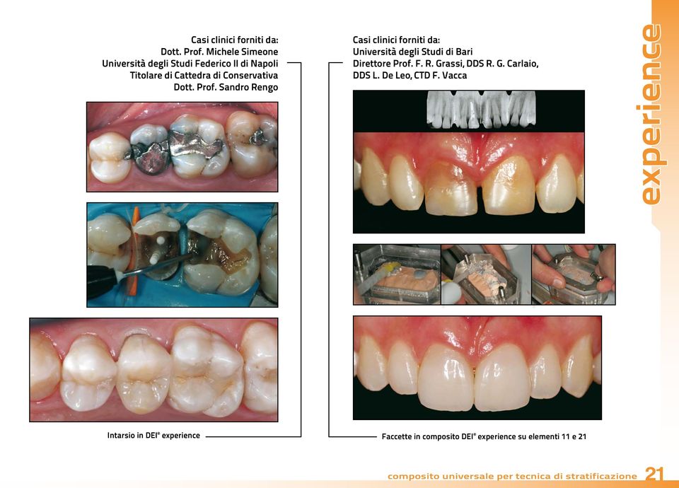 Sandro Rengo Casi clinici forniti da: Università degli Studi di Bari Direttore Prof. F. R. Grassi, DDS R. G. Carlaio, DDS L.