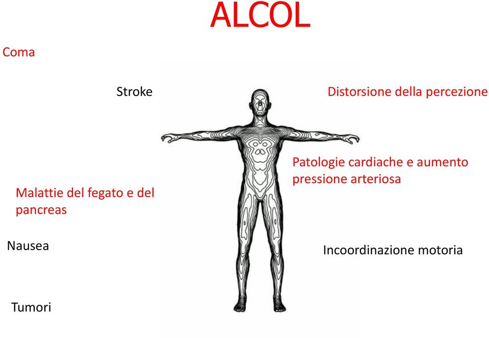 pancreas Nausea Patologie cardiache e