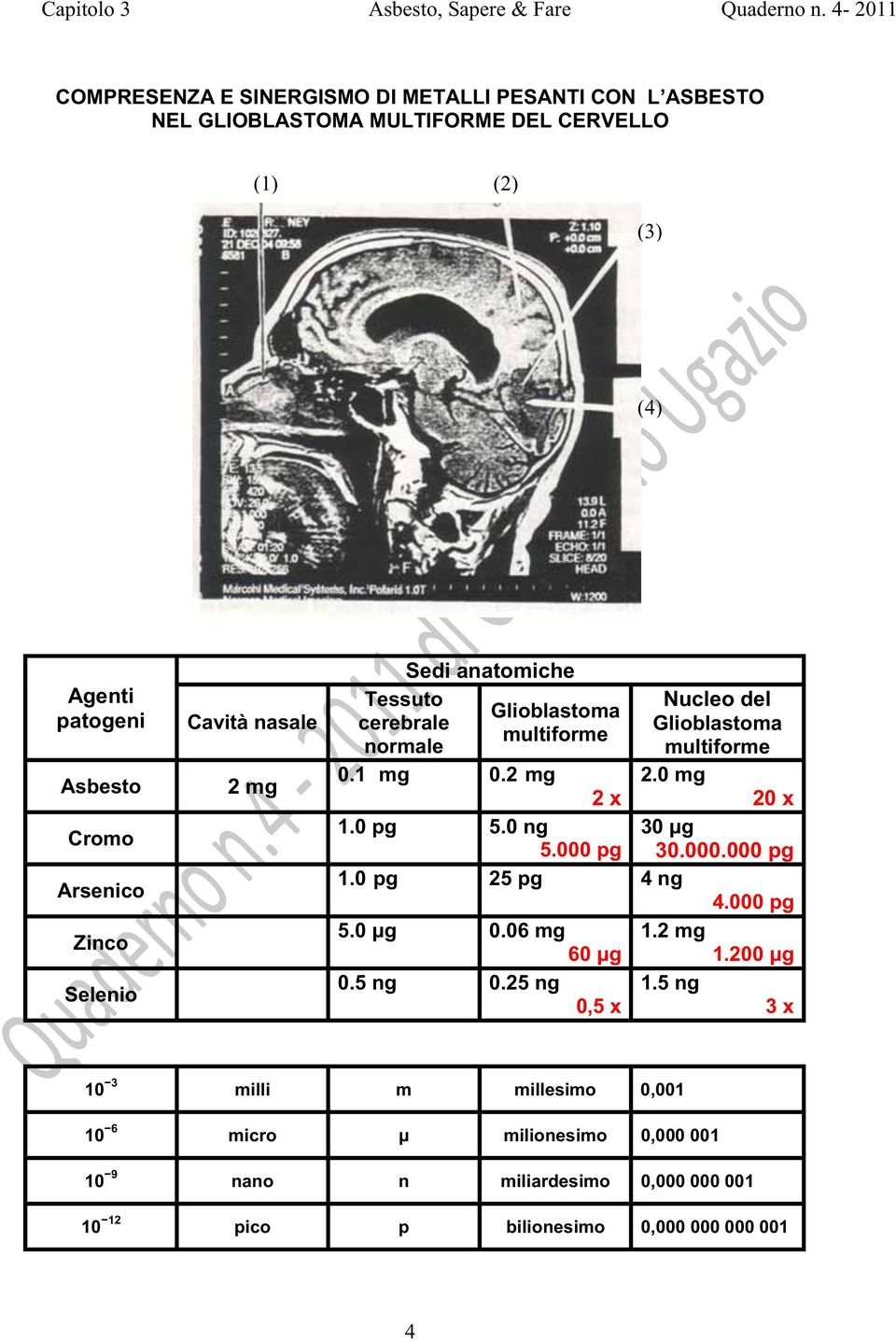 Tessuto cerebrale normale Sedi anatomiche Glioblastoma multiforme Nucleo del Glioblastoma multiforme 2.0 mg 20 x 30.000.000 pg 0.1 mg 0.