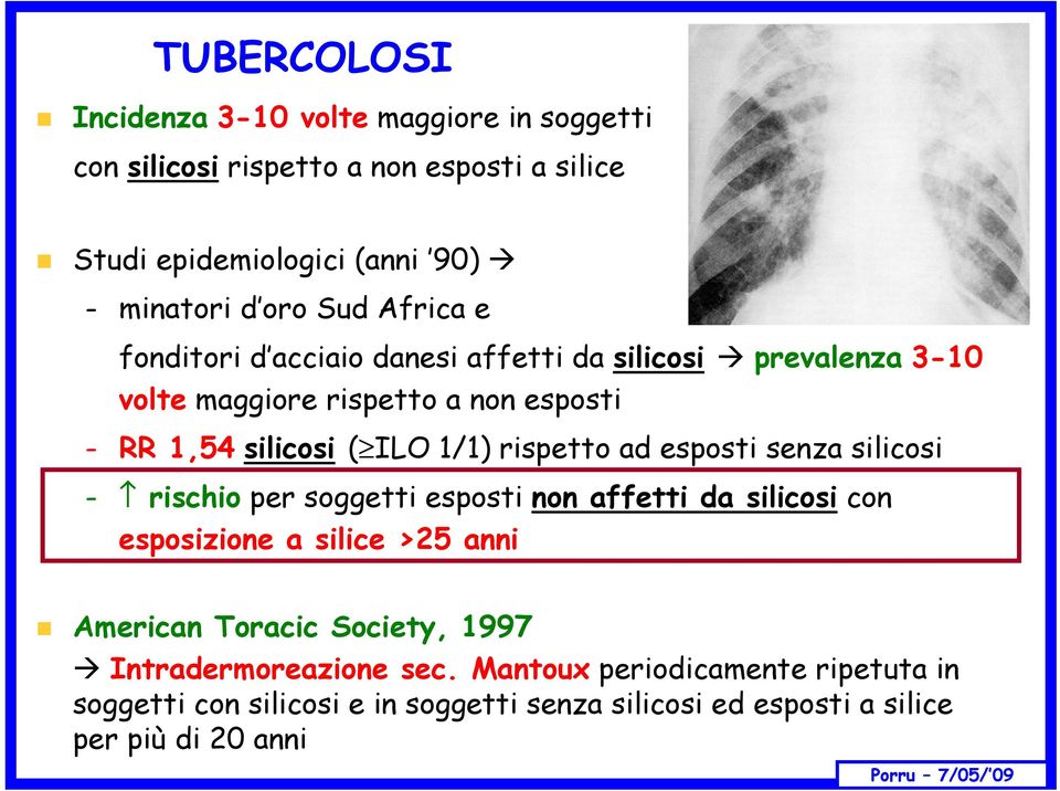 rispetto ad esposti senza silicosi rischio per soggetti esposti non affetti da silicosi con esposizione a silice >25 anni American Toracic