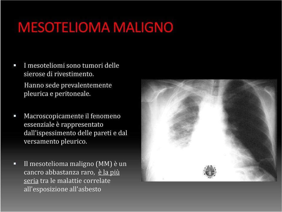 Macroscopicamente il fenomeno essenziale è rappresentato dall ispessimento delle pareti e