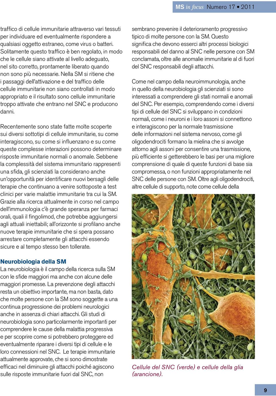 Nella SM si ritiene che i passaggi dell attivazione e del traffico delle cellule immunitarie non siano controllati in modo appropriato e il risultato sono cellule immunitarie troppo attivate che