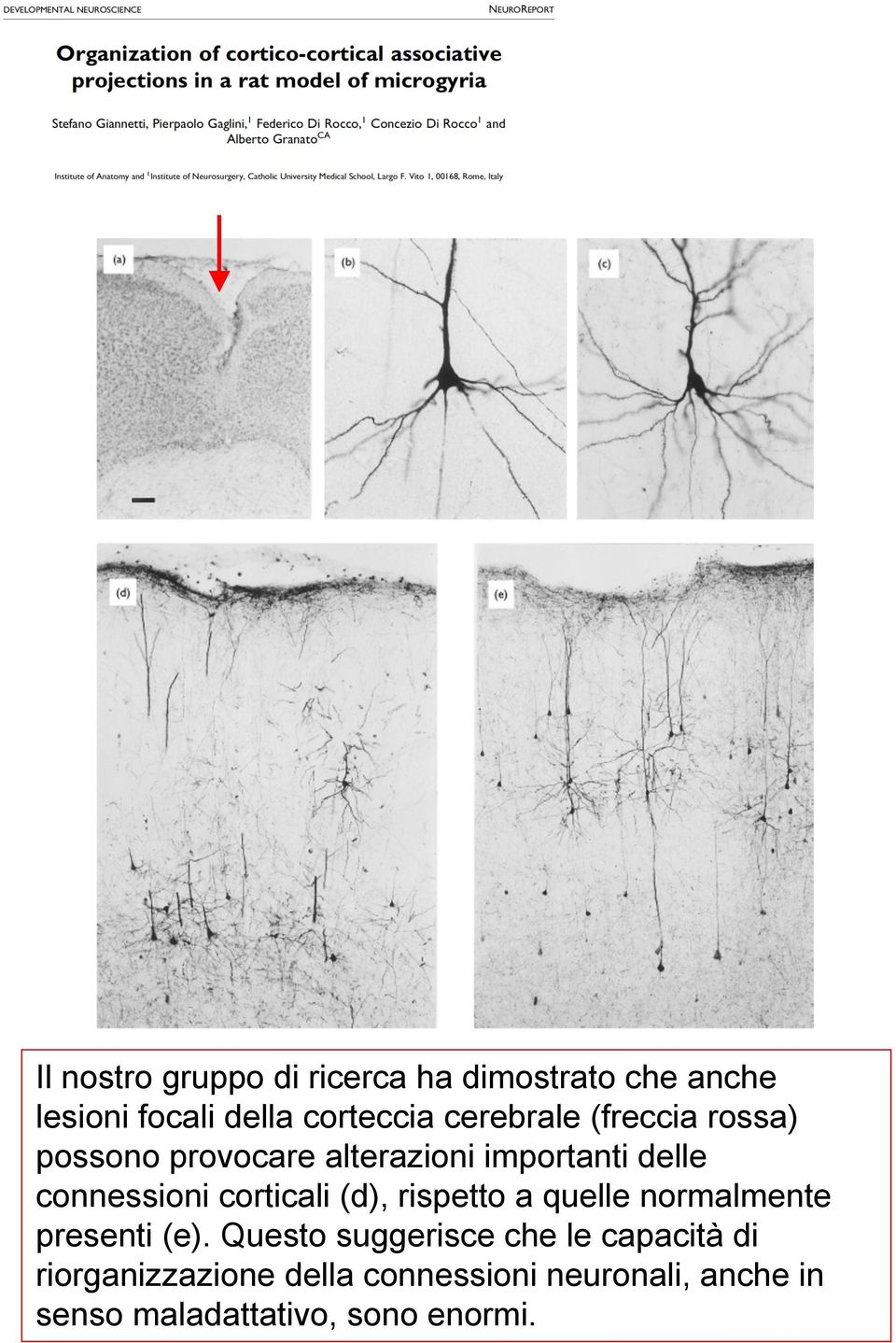 corticali (d), rispetto a quelle normalmente presenti (e).