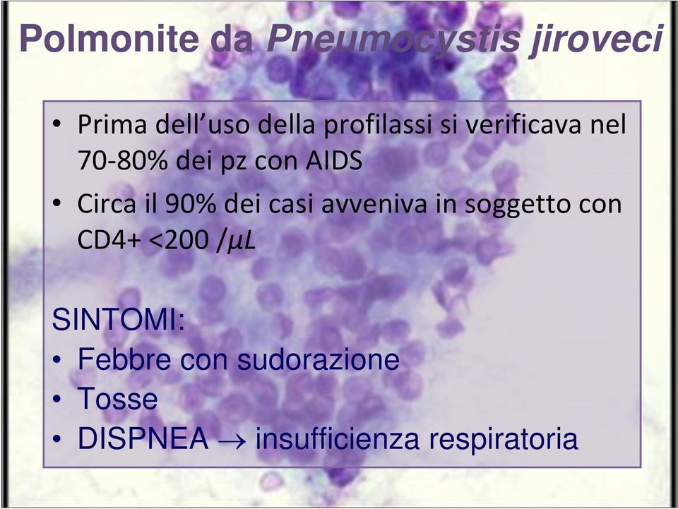 90% dei casi avveniva in soggetto con CD4+ <200 /μl SINTOMI: