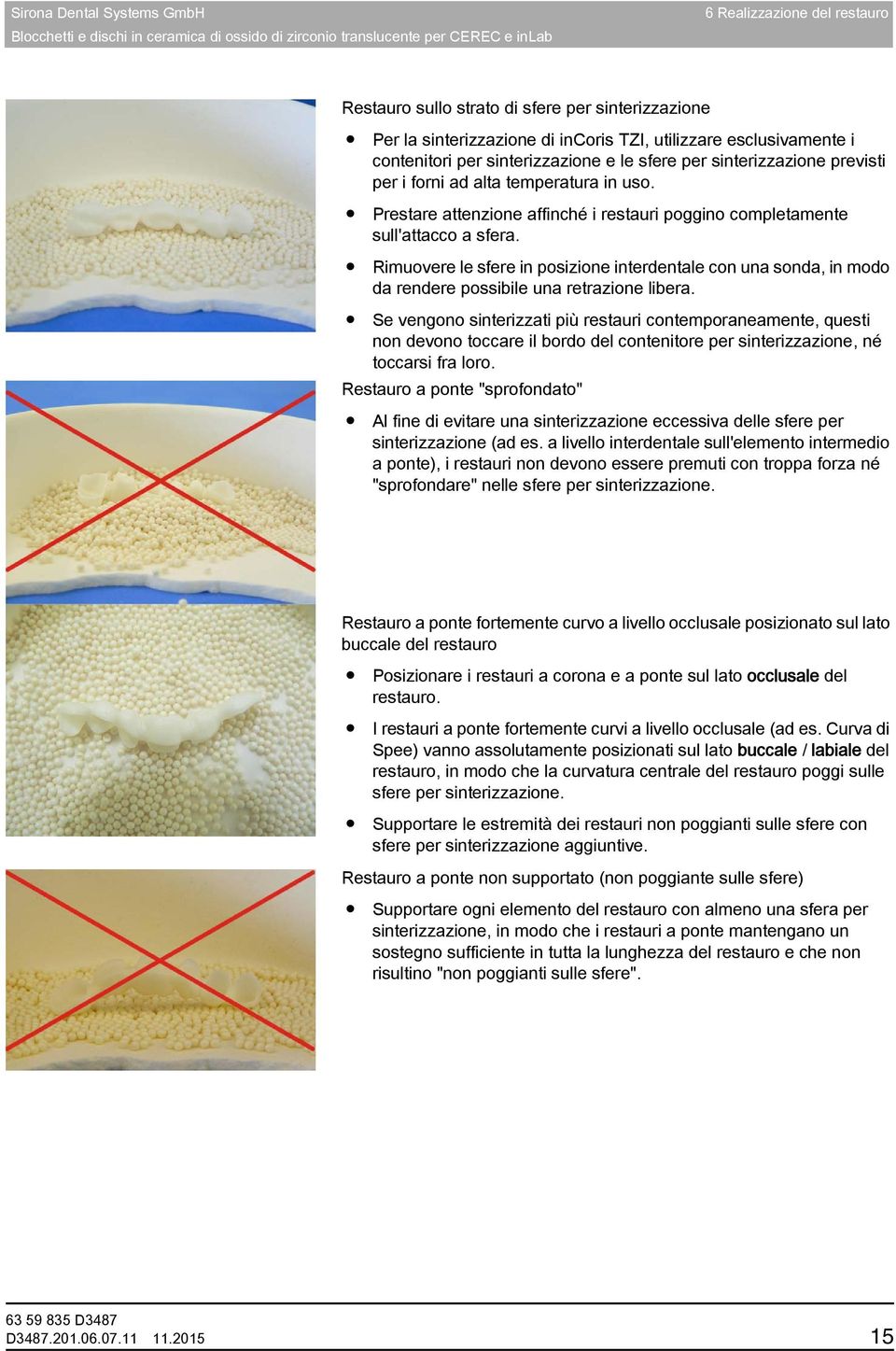 Rimuovere le sfere in posizione interdentale con una sonda, in modo da rendere possibile una retrazione libera.