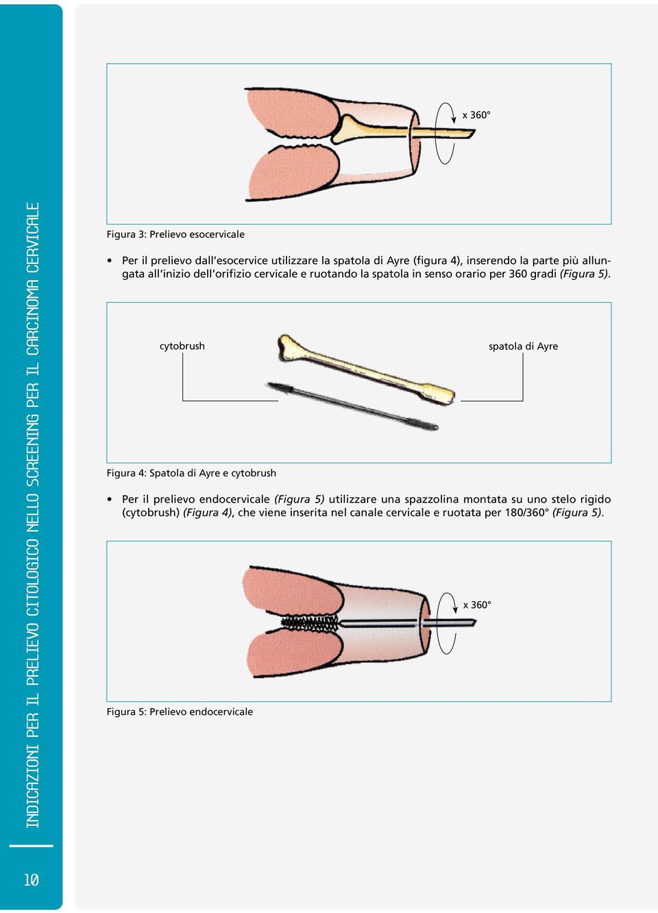 cytobrush Figura 4: Spatola di Ayre e cytobrush spatola di Ayre Per il prelievo endocervicale (Figura 5) utilizzare una spazzolina