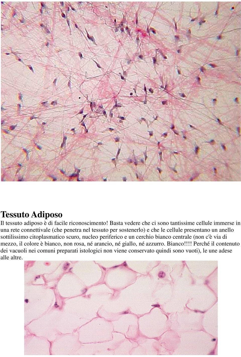 cellule presentano un anello sottilissimo citoplasmatico scuro, nucleo periferico e un cerchio bianco centrale (non c'è via di