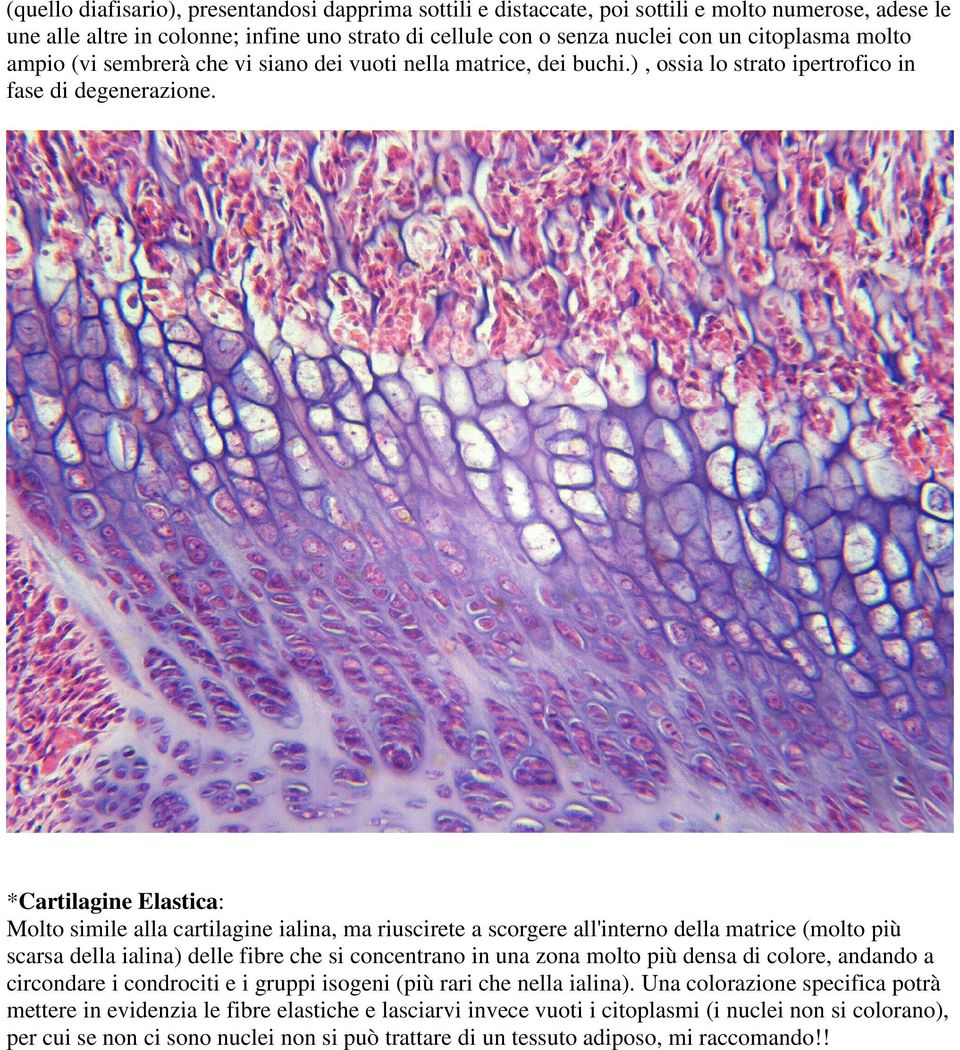 *Cartilagine Elastica: Molto simile alla cartilagine ialina, ma riuscirete a scorgere all'interno della matrice (molto più scarsa della ialina) delle fibre che si concentrano in una zona molto più