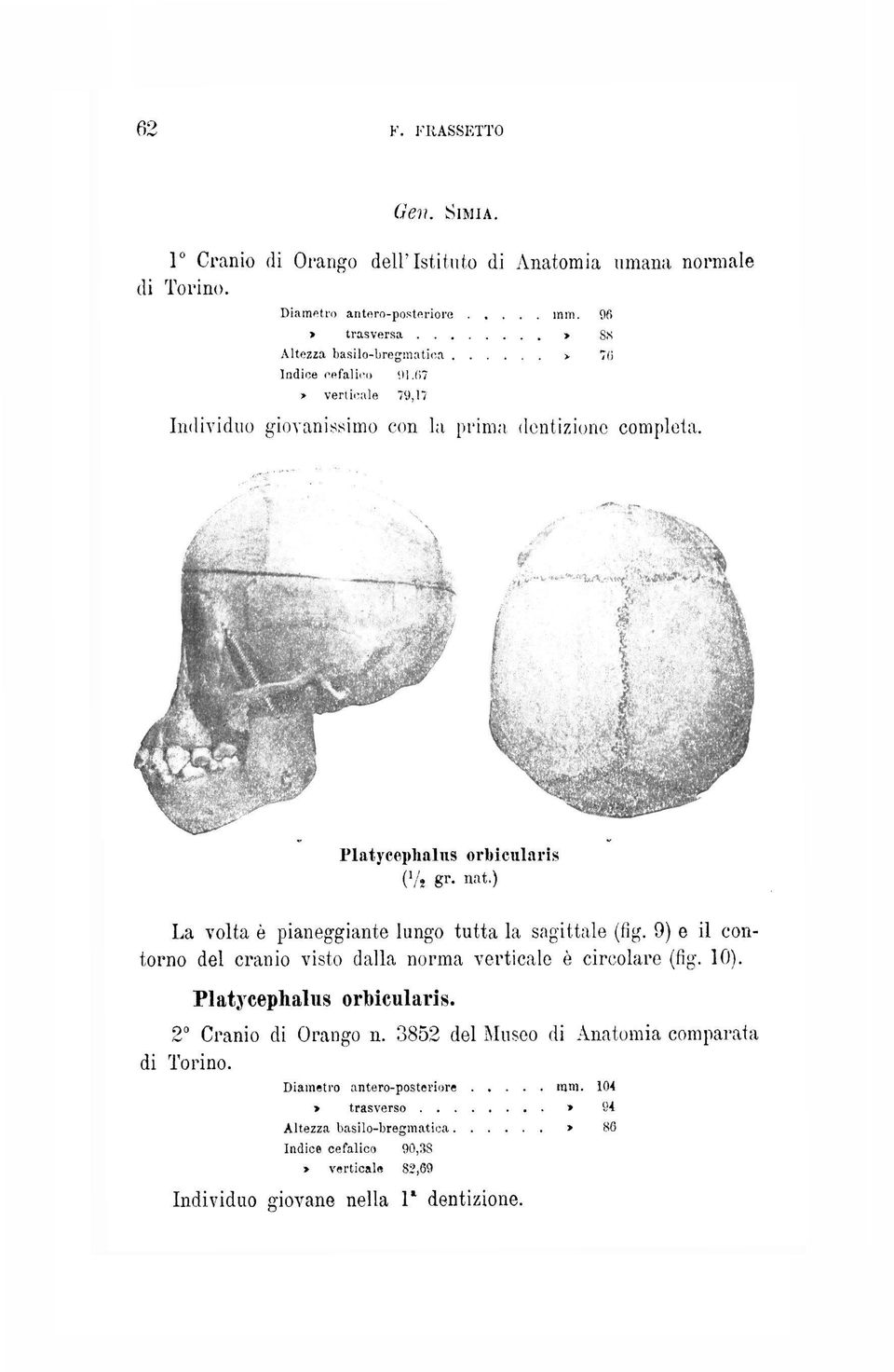 nat.) orbicularis La volta è pianeggiante lungo tutta la sagittale (fig. 9) e il contorno del cranio visto dalla norma verticale è circolare (fig. 10). Platycephalus ormcularis.