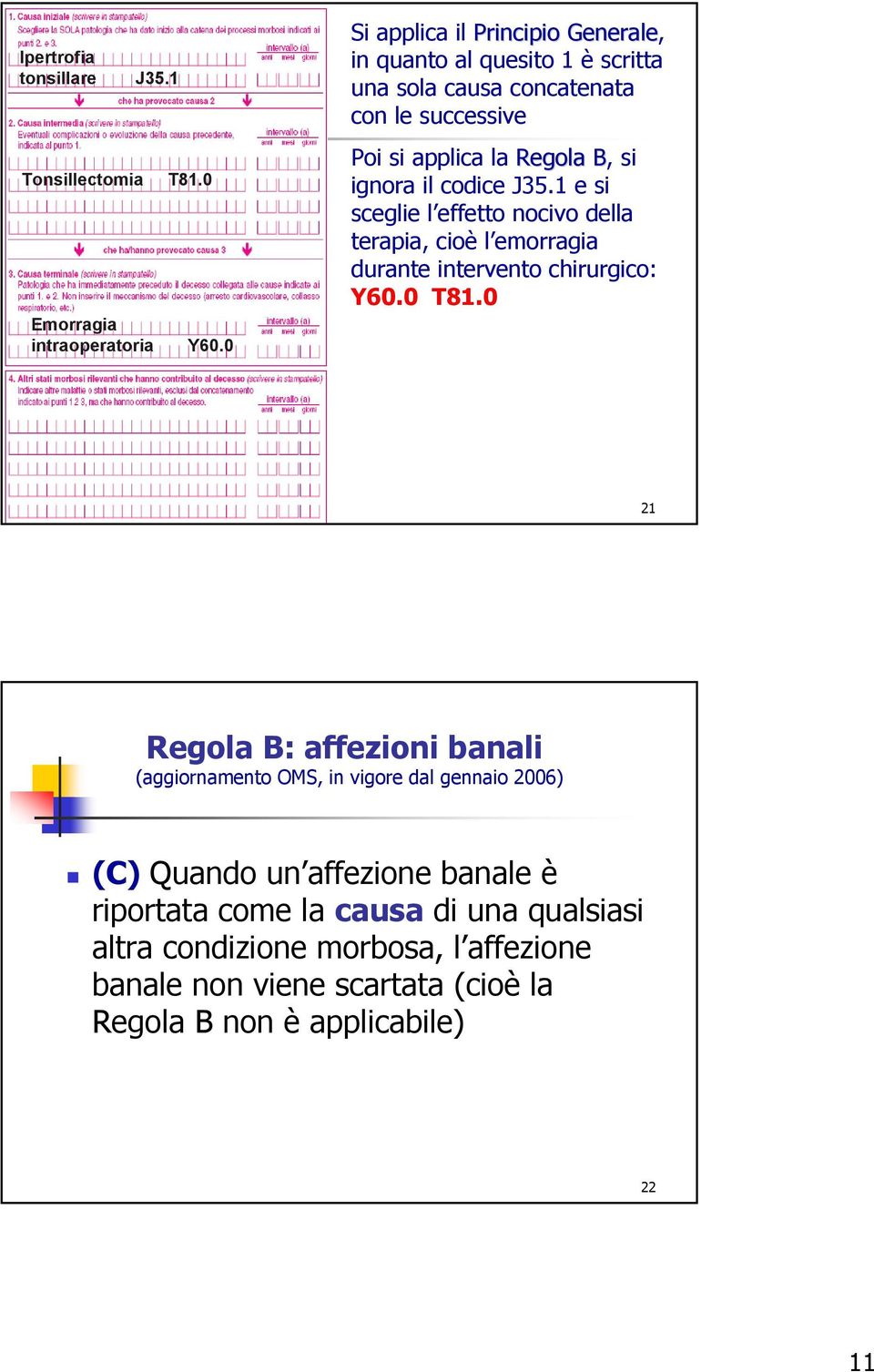 ignora il codice J35.1 e si sceglie l effetto nocivo della terapia, cioè l emorragia durante intervento chirurgico: Y60.0 T81.