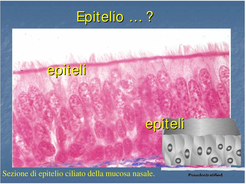 ciliato