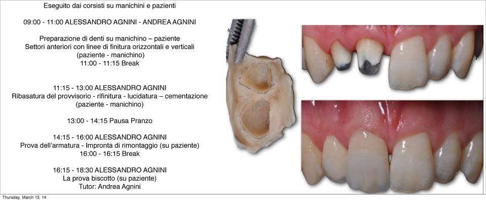 Ribasatura del provvisorio - rifinitura - lucidatura cementazione (paziente - manichino) 14:15-16:00 ALESSANDRO AGNINI Prova