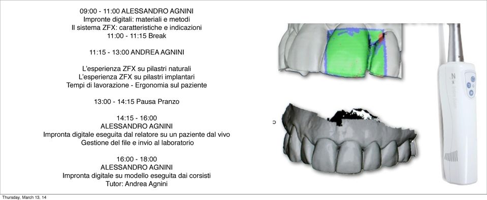 lavorazione - Ergonomia sul paziente 14:15-16:00 ALESSANDRO AGNINI Impronta digitale eseguita dal relatore su un