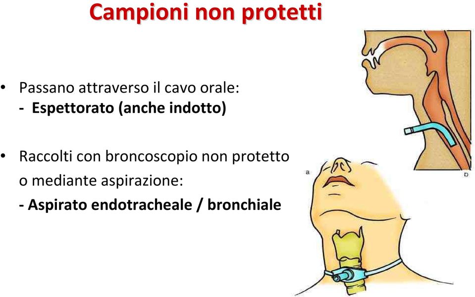 Raccolti con broncoscopio non protetto o