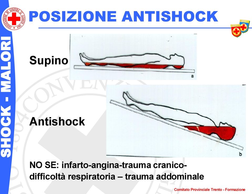 infarto-angina-trauma