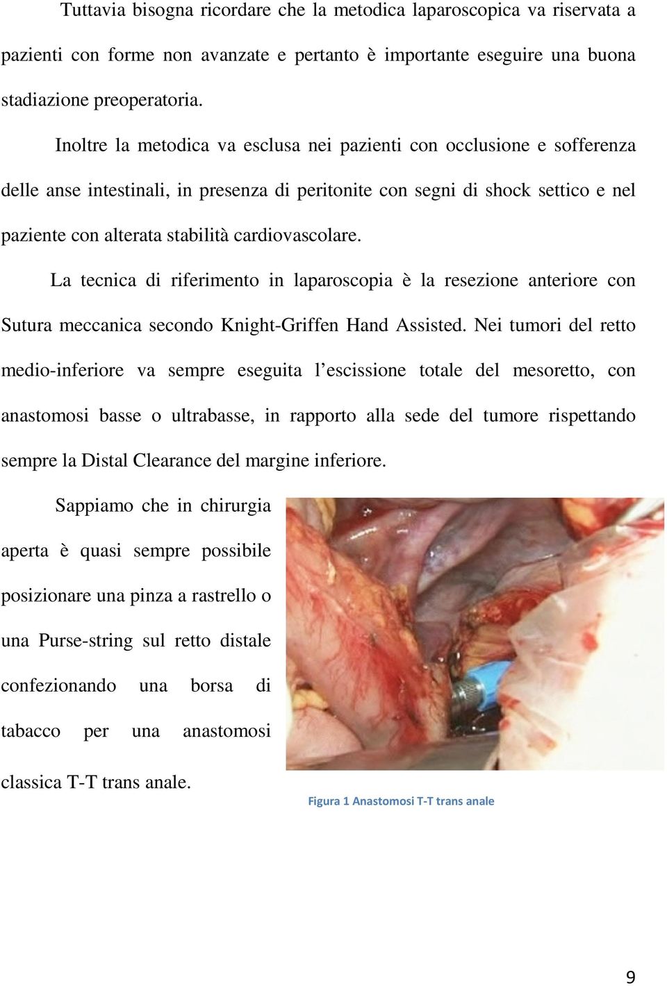 cardiovascolare. La tecnica di riferimento in laparoscopia è la resezione anteriore con Sutura meccanica secondo Knight-Griffen Hand Assisted.