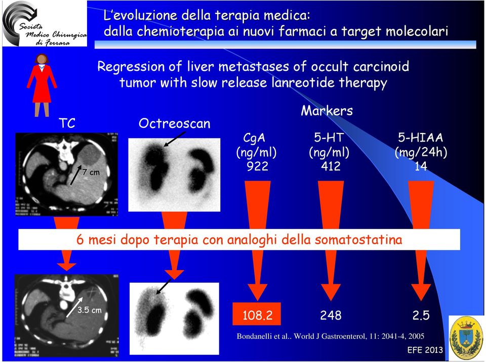 412 5-HIAA (mg/24h) 14 6 mesi dopo terapia con analoghi della somatostatina