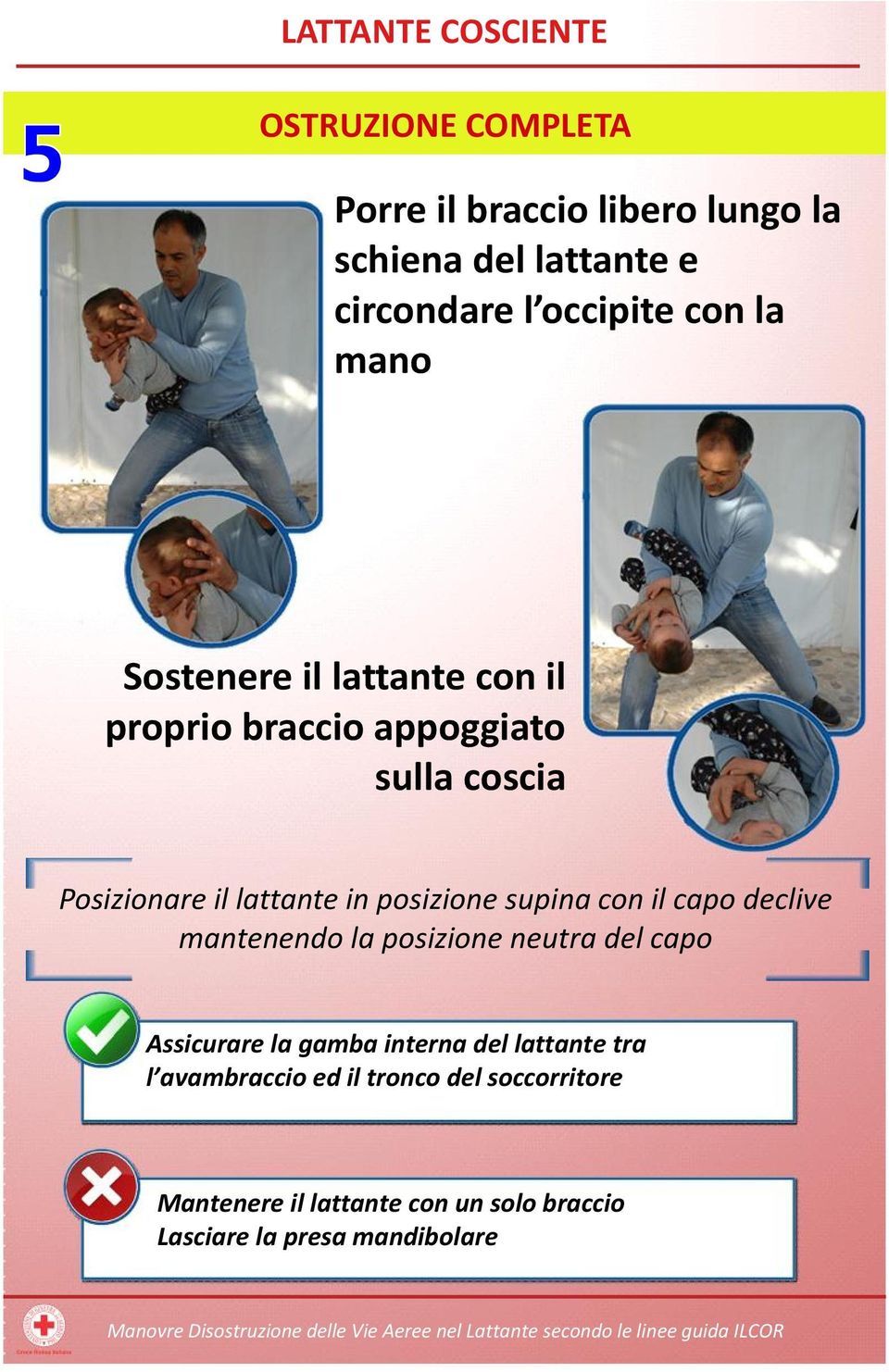 posizione neutra del capo Assicurare la gamba interna del lattante tra l avambraccio ed il tronco del soccorritore Mantenere il