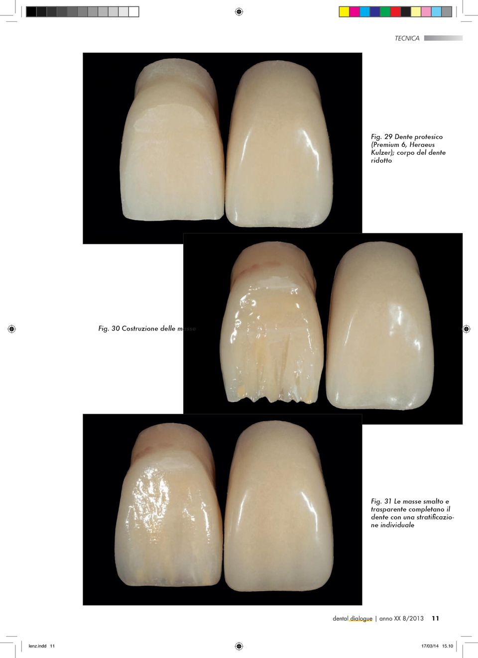 31 Le masse smalto e trasparente completano il dente con una