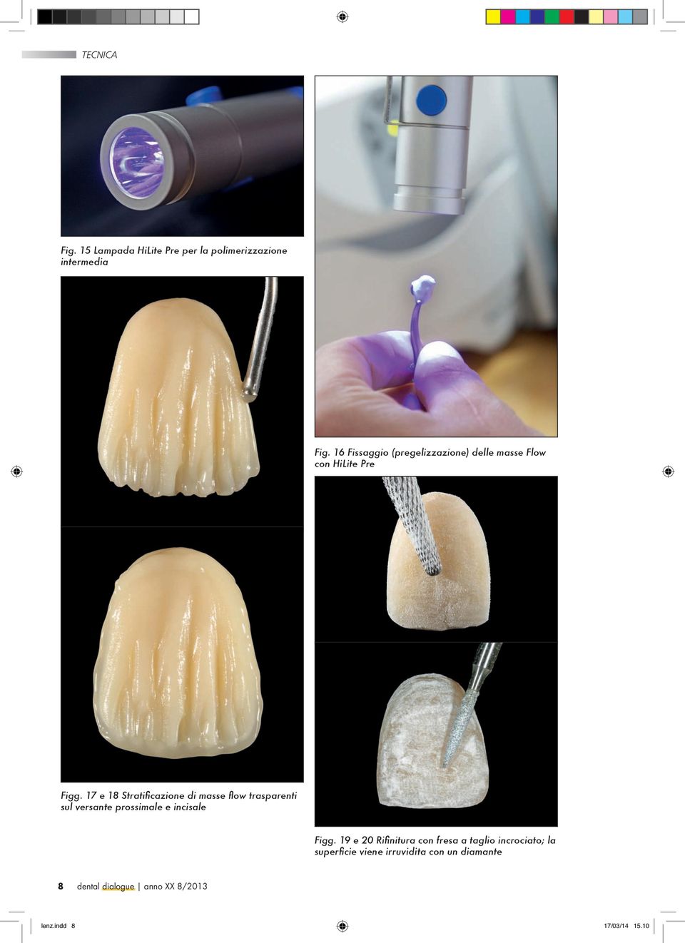 17 e 18 Stratificazione di masse flow trasparenti sul versante prossimale e incisale Figg.