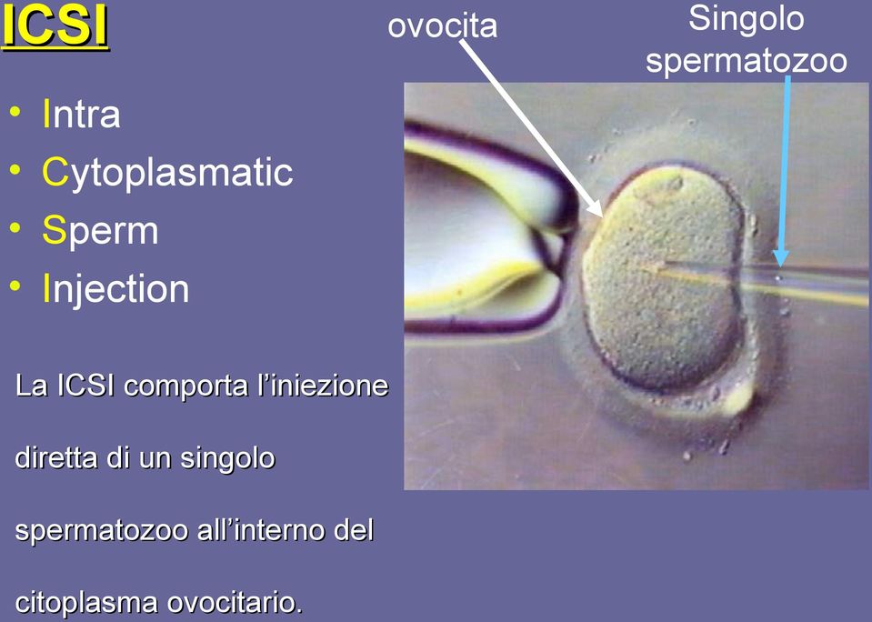 comporta l iniezione diretta di un singolo