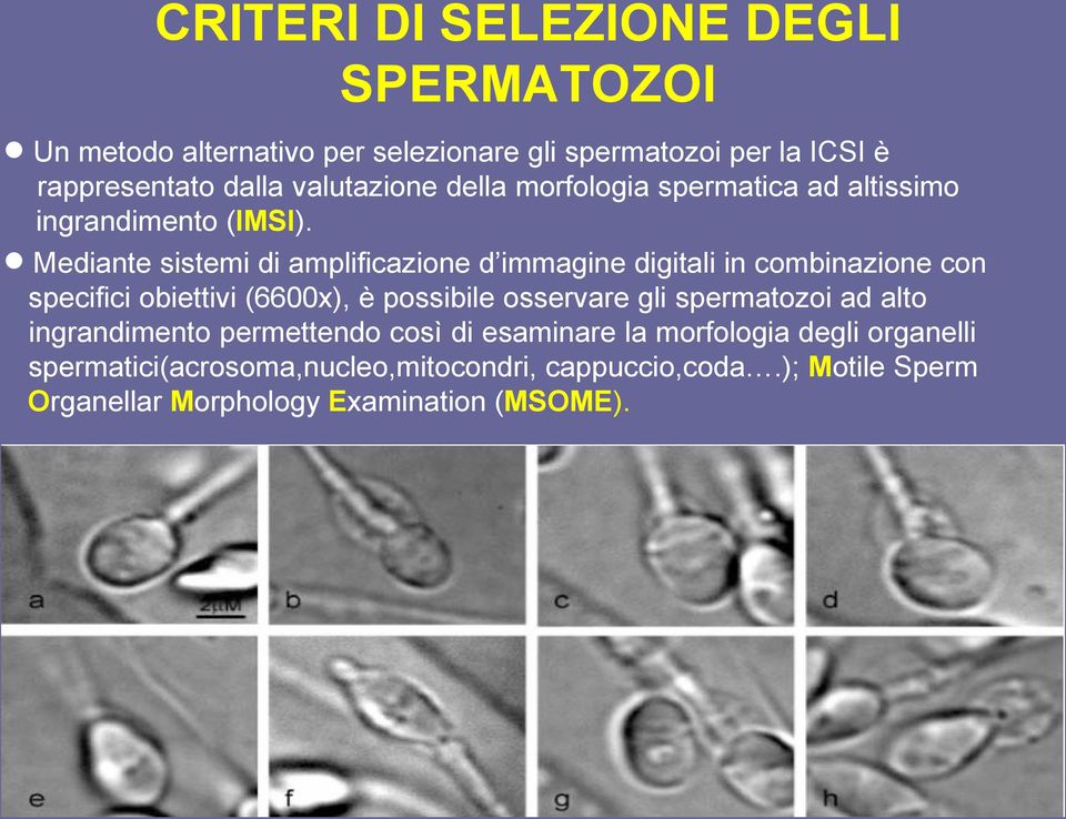 Mediante sistemi di amplificazione d immagine digitali in combinazione con specifici obiettivi (6600x), è possibile osservare gli