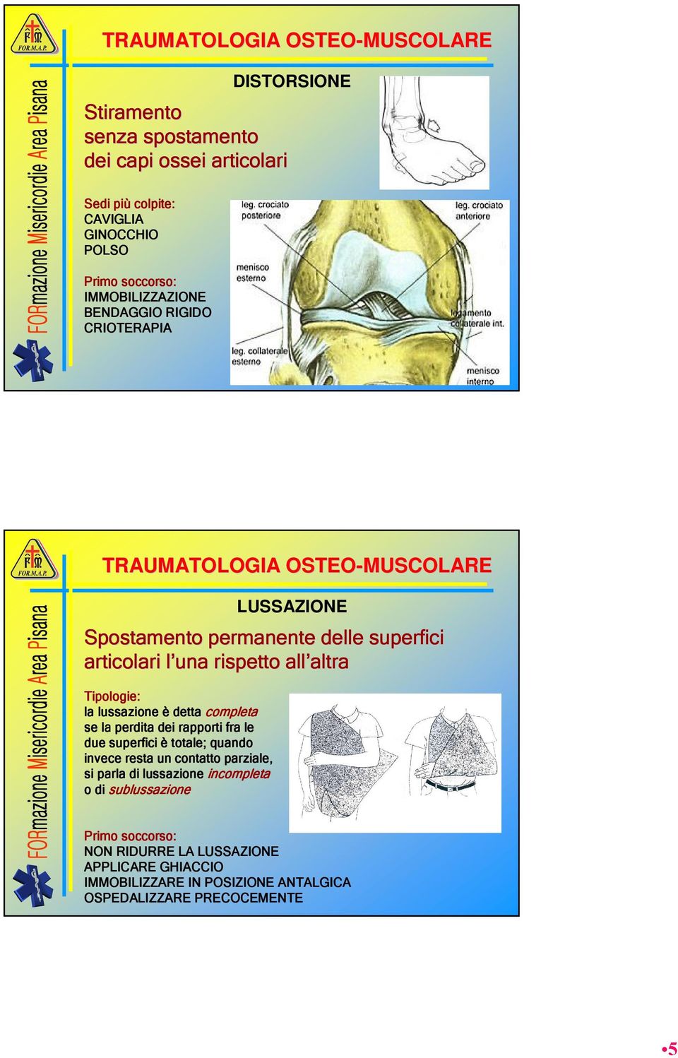 altra Tipologie: la lussazione è detta completa se la perdita dei rapporti fra le due superfici è totale; quando invece resta un contatto parziale, si parla di