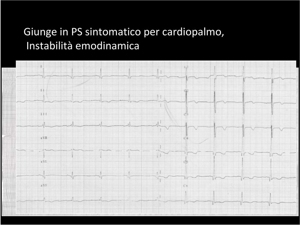 cardiopalmo,