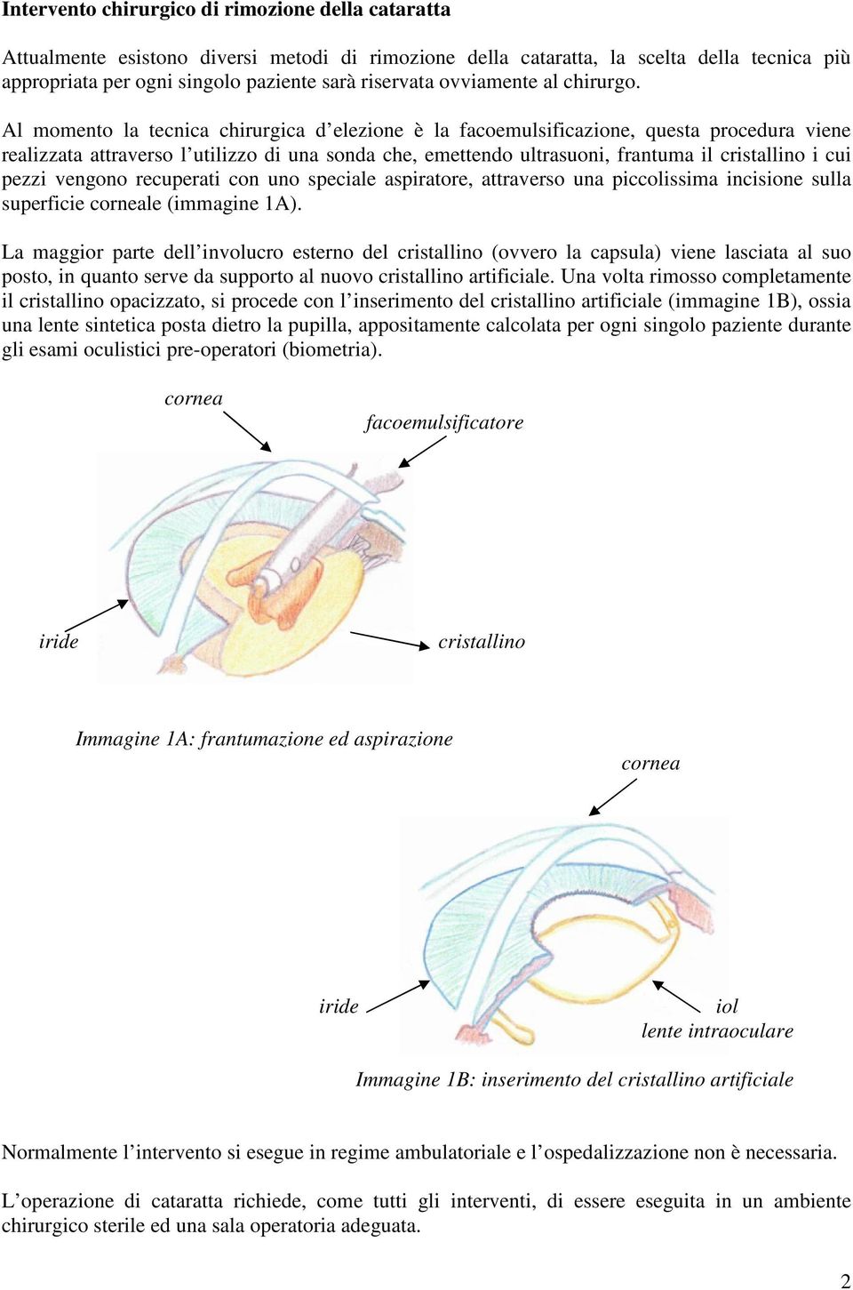 Al momento la tecnica chirurgica d elezione è la facoemulsificazione, questa procedura viene realizzata attraverso l utilizzo di una sonda che, emettendo ultrasuoni, frantuma il cristallino i cui