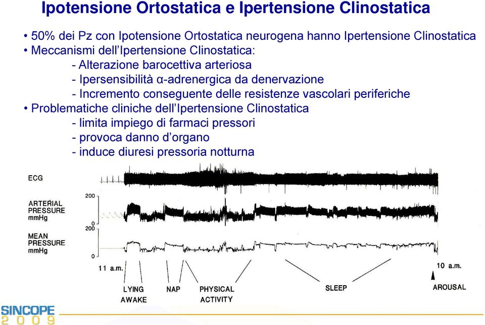 Ipersensibilità α-adrenergica da denervazione - Incremento conseguente delle resistenze vascolari periferiche