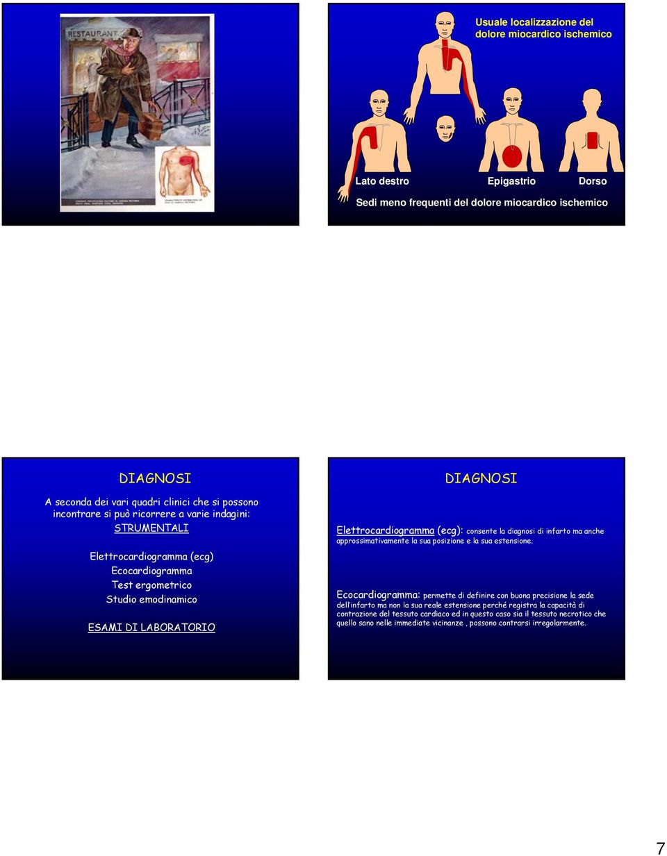 (ecg): consente la diagnosi di infarto ma anche approssimativamente la sua posizione e la sua estensione.