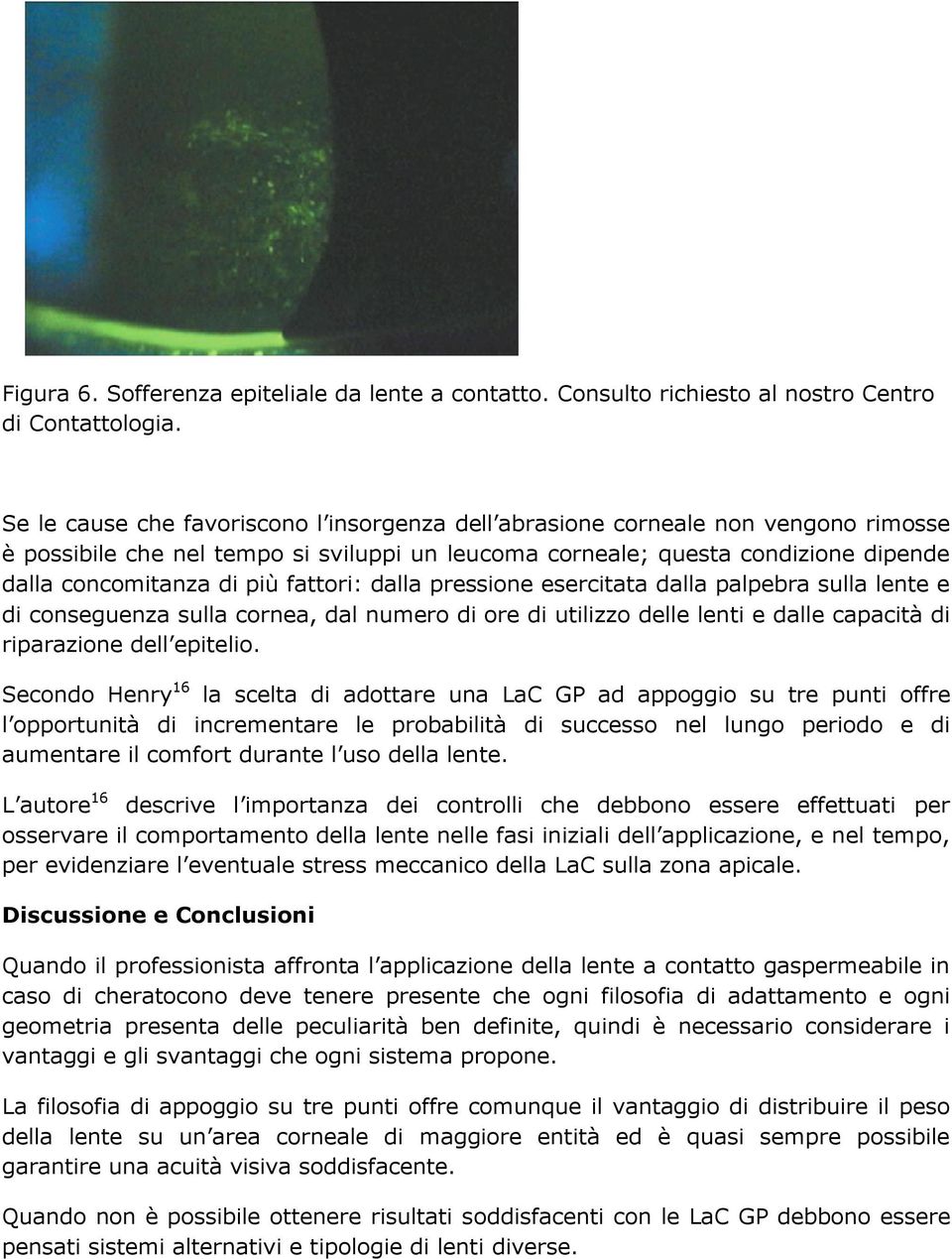 fattori: dalla pressione esercitata dalla palpebra sulla lente e di conseguenza sulla cornea, dal numero di ore di utilizzo delle lenti e dalle capacità di riparazione dell epitelio.