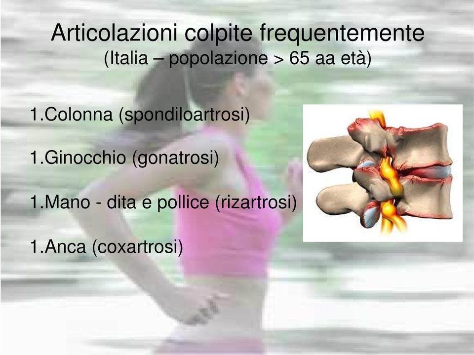 Colonna (spondiloartrosi) 1.