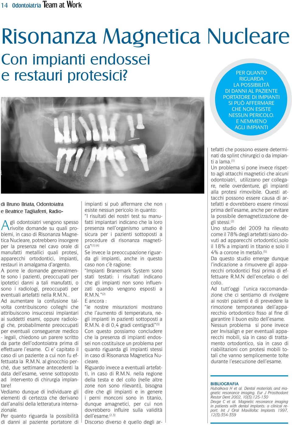 E NEMMENO AGLI IMPIANTI di Bruno Briata, Odontoiatra e Beatrice Tagliaferri, Radio- Agli odontoiatri vengono spesso rivolte domande su quali problemi, in caso di Risonanza Magnetica Nucleare,