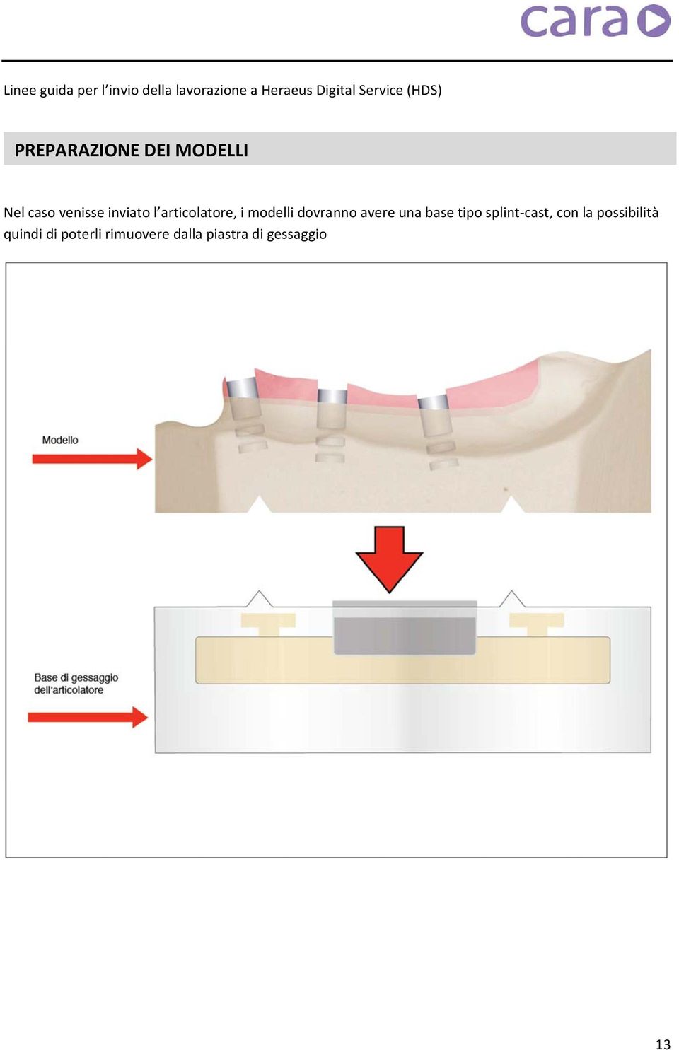 una base tipo splint-cast, con la possibilità