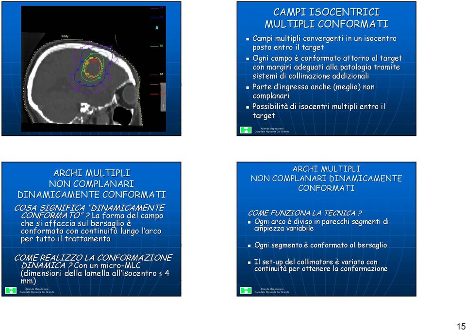 DINAMICAMENTE CONFORMATO? La forma del campo che si affaccia sul bersaglio è conformata con continuità lungo l arco per tutto il trattamento COME REALIZZO LA CONFORMAZIONE DINAMICA?